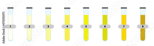 Urine Color scale chart. Scale to analyse the hydration of a patient based on the urine color.