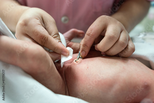 A nurse is cleaning the umbilical cord of newborn baby. Health care and medical action photo. Close-up and selective focus.
