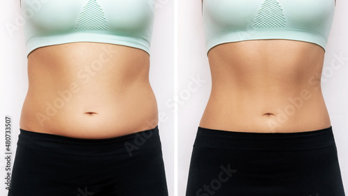 Two shots of a woman's belly with excess fat and toned slim stomach with abs before and after losing weight isolated on a white background. Result of diet, liposuction, training. Healthy lifestyle