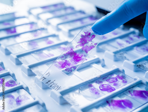 Hand in blue glove holding glass histology slides