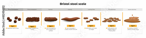 Vector isolated cartoon illustration on white of a set different types human feces, excrement in normal and diseases of diarrhea and constipation. A scale with information for correct diagnosis.