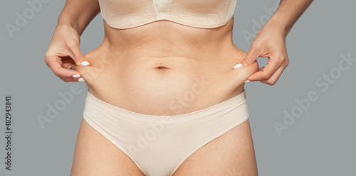 The girl tightens the skin on her stomach, showing fat deposits in the abdomen and sides. Treatment and getting rid of excess weight, deposition of subcutaneous fat.