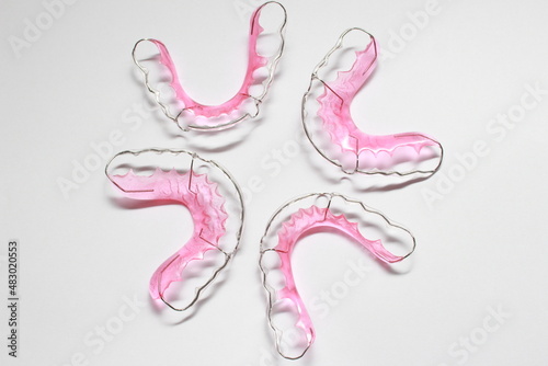 Retainer, colorful, pink, with wire bending, for wearing after orthodontics.