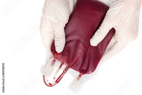 A doctor in latex gloves holding a blood bag. Blood transfusion and blood donation concept.