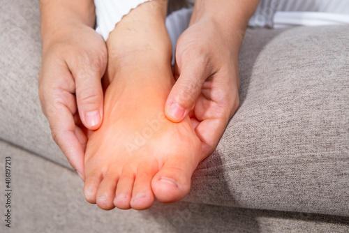Close-up of a woman massage painful toes at home. Bare foot of woman with painful red bunion (Hallux valgus) and injury foot, Problems from wearing high heel. medical foot problem.