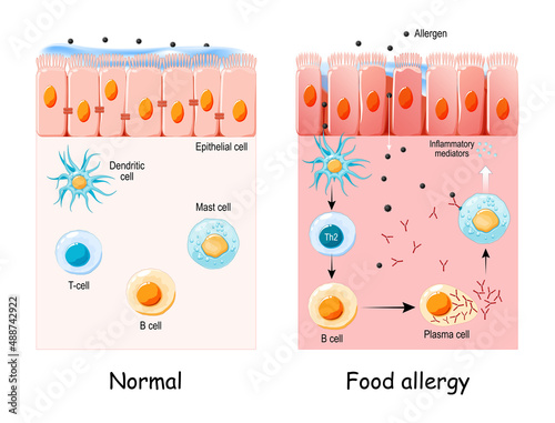 food allergy. development of an allergic reaction