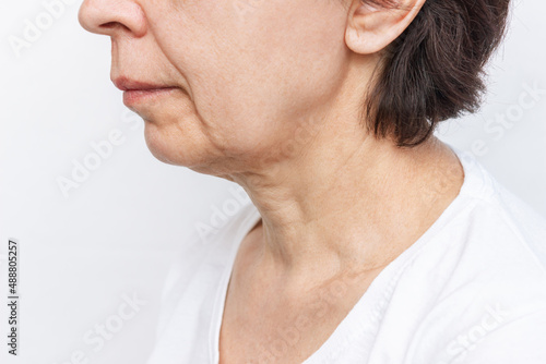 The lower part of the face and neck of an elderly woman with signs of skin aging isolated on a white background. Age-related changes, flabby sagging facial skin. Cosmetology and beauty concept