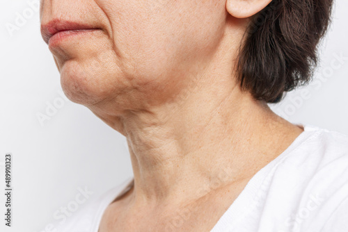 The lower part of elderly woman's face and neck with signs of skin aging isolated on a white background. Age-related changes, flabby sagging facial skin. Cosmetology and beauty concept