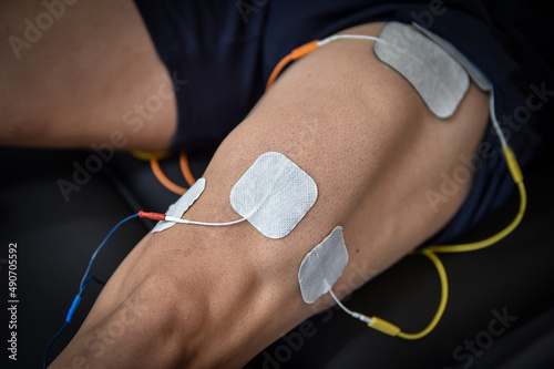 Muscle stimulator device with electrodes applied to quadriceps by a professional physiotherapist