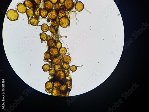 Arbuscular Mycorrhizal Fungi. Photomicrograph. Microscopic image of inactive root blade colonized by spores.