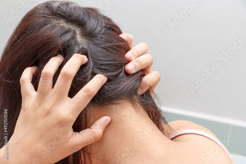 Women itching scalp