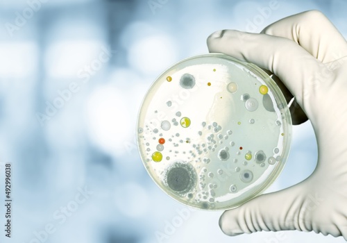 Backgrounds of Characteristics and Different shaped Colony of Bacteria and Mold growing on plates