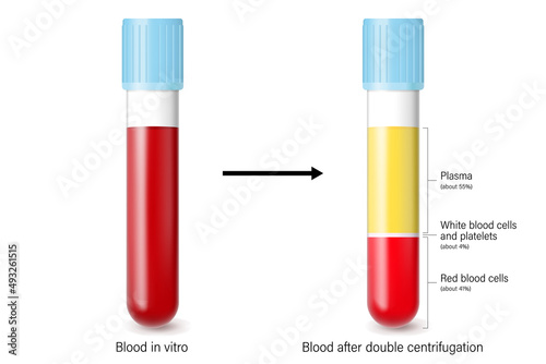 Blood in vitro and blood after double centrifugation. Plasma, red blood cells, white blood cells and platelets. Medical laboratory.