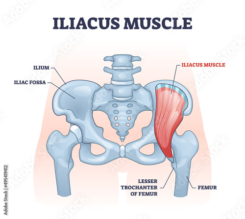 Iliacus muscle with hip or groin muscular and skeletal anatomy outline diagram. Labeled educational scheme with human lesser trochanter of femur and iliac fossa bones location vector illustration.