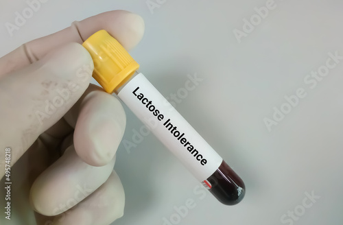 Blood sample for lactose intolerance test.