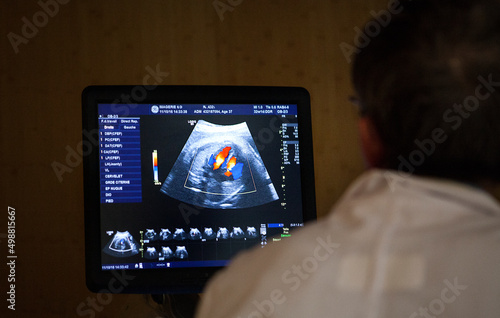 A doctor radiologist performs an ultrasound of the third trimester.