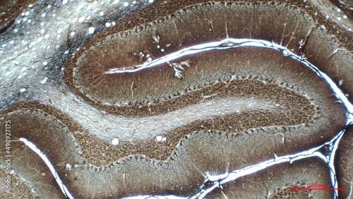 The cerebellar cortex is divided into three layers. At the bottom lies the thick granular layer, densely packed with granule cells. In the middle lies the Purkinje layer. Silver-nitrate impregnated.