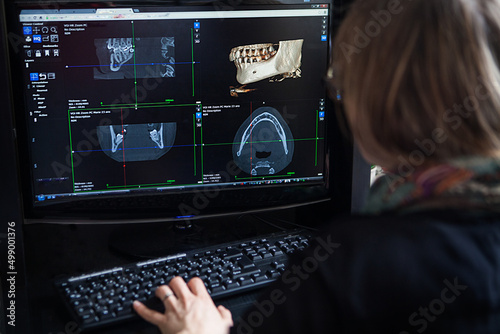 3D reconstruction from a scanner image of a patient's jaw.