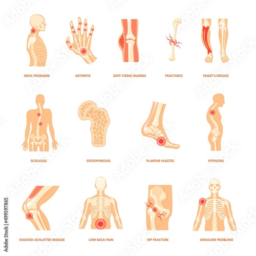 Body orthopedic problem. Human bone injury, anatomy health diseases plantar fasciitis arthritis joint fracture foot pain shoulder knee back ankle sport injuries cartoon neat vector