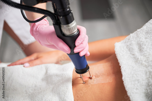 Close up cosmetologist hand in sterile gloves using erbium ablative laser machine while performing lifting procedure on female abdomen. Young woman receiving laser treatment in cosmetology clinic.