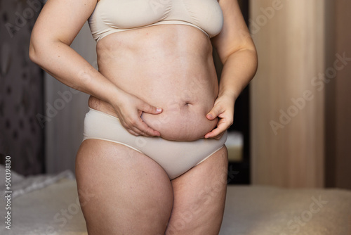 Cropped image of overweight obese woman, hiding fat naked big excessive abdomen with navel in underwear. Dangling down tummy. Drag away of abdomen. Planning liposuction surgery, cellulite problem 