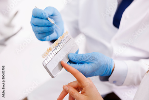 Dentist showing dentail facets color palette to patient