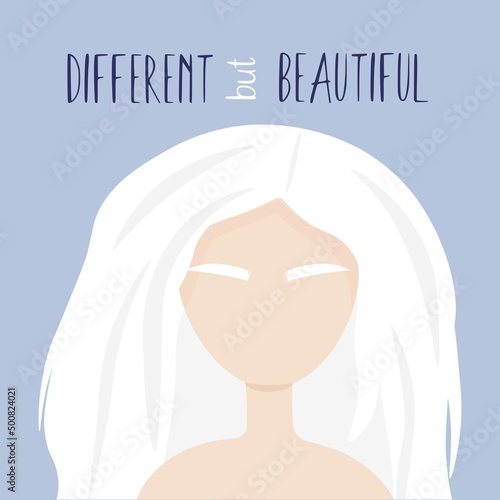 International albinism awareness day, 13 June. Illustration of albino woman for banner,poster or template. Woman white hair, lack of melan pigment. People with albinism. Albino human rights support.