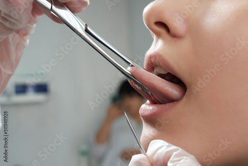 Tongue piercing operation Professional holding the jewel.