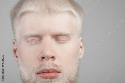 Albinism, abnormal deviations concept. Unusual bearded albino man posing with closed eyes, grey background, copy space