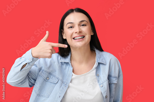 Beautiful woman pointing at dental braces on red background