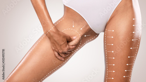 Unrecognizable young woman pinching her inner thigh, examining cellulite