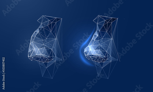 Rhinoplasty, nose surgery in a futuristic polygonal style. Vector illustration demonstrates changes in the shape of the nose after plastic surgery. Concept aesthetic medicine result before and after