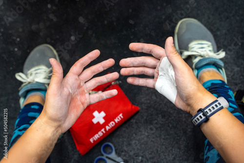 Palms with blisters. First aid. Corns on injured hands of intense lifting heavy weights in training in gym. Patch on the palm. The concept of hard workout. Hands of a person in sportswear. Close up. 