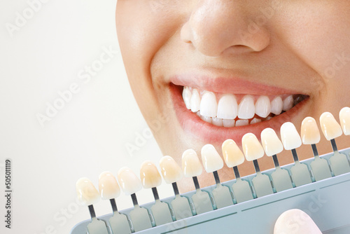 Smiling young woman. Cosmetological teeth whitening in a dental clinic. selection of the tone of the implant tooth