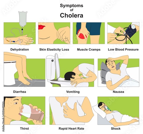 Symptoms of cholera epidemic infectious disease infographic diagram diagnosis signs for medical science education illness cartoon vector drawing chart illustration scheme physical examination test