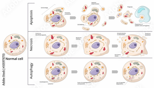 Three basic forms of cell death: apoptosis (chromosome condensation, nuclear fragmentation), autophagy (autophagosome formation), necrosis (membrane rupture, organelles swelling). 