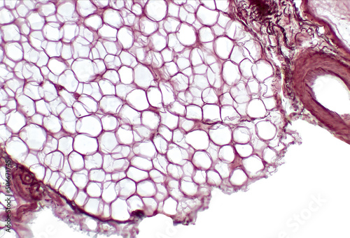 White adipose tissue. Adipose tissue, body fat, or simply fat is a loose connective tissue composed mostly of adipocytes.