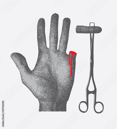 human hand with cut off finger on medical tweezers with blood