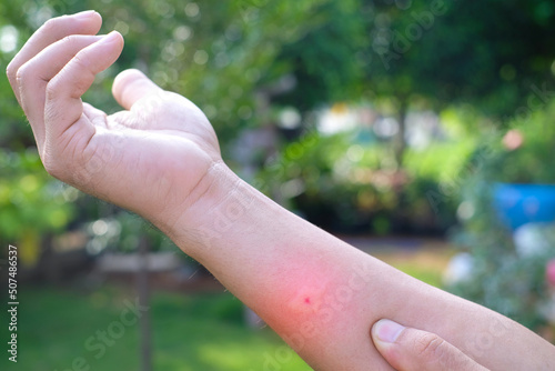 Swollen arms due to mosquito bites, poisonous animals, plague in the rainy season