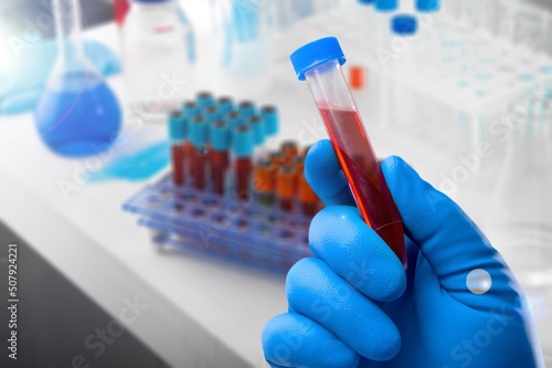 Blood sample of patient for test in laboratory. Doctor with Blood tube test in lab