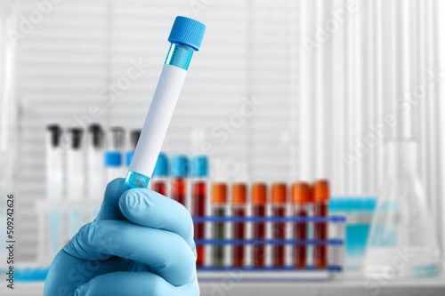 Blood sample of patient for test in laboratory. Doctor with Blood tube test in lab