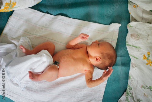 Newborn baby with clip on umbilical cord on diaper on bed, top view. Gentle innocent baby lies at home