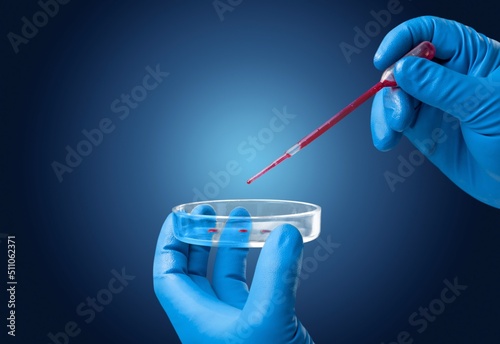 Lab scientist performing a rapid diagnostic test RDT for antibodies by COVID-19 corona virus disease, quick fast antibody point of care testing