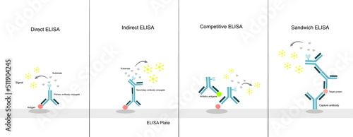 The principle of Enzyme-Linked Immunosorbent (ELISA) Assay: Direct, Indirect, Competitive, and Sandwich ELISA technique 