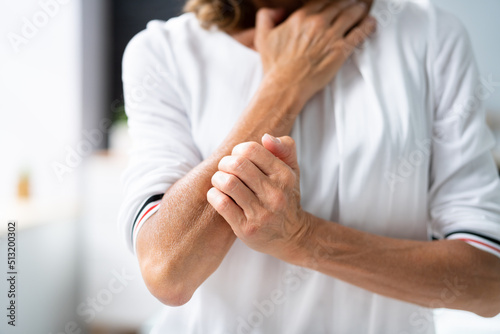 Woman Scratching Itching Body Skin