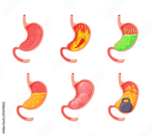 Empty and full stomach. Bloating stomach ache, gerd digestive tract pain fullness heaviness stomaches, acid heartburn process indigestion duodenum reflux, neat vector illustration