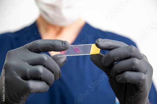 doctor in black gloves holds stained histology slide which is ready for microscopic examination. Cytology. 