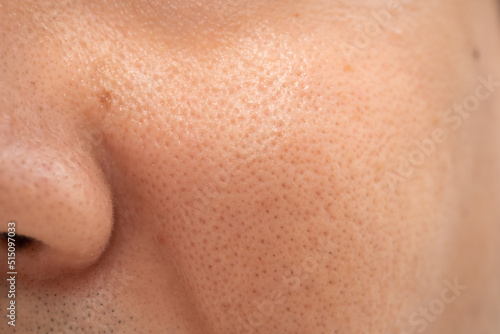 Asian male nose and cheek close up has skin problem, large pores, whitehead and blackhead pimple. Pores on the face of a man.