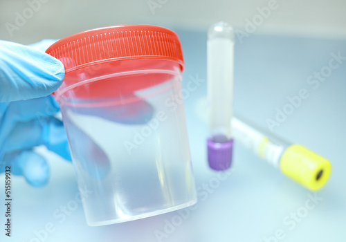 Gloved hand holds sterile container for biomaterials, blood collection tubes. Container for urine and stool samples. Test tubes for blood samples. Biomaterials collection. Medical laboratory equipment