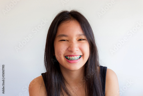 portrait of asian woman face with colorful braces and smile happily